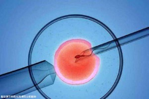 供卵代生套餐